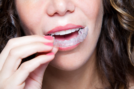 Image of woman holding her top try of her invisalign braces she received from A Glamorous Smile in New Port Richey, FL.